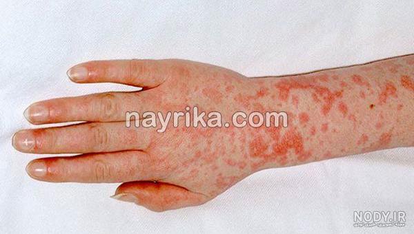 زبان توت فرنگی نی نی سایت