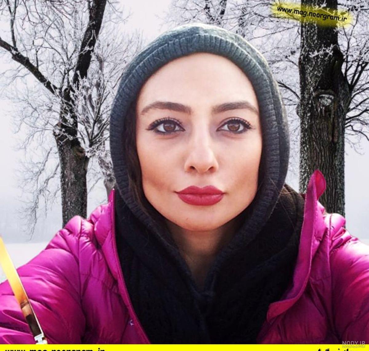 عمل زیبایی صورت بهاره رهنما عمل زیبایی صورت بهاره رهنما