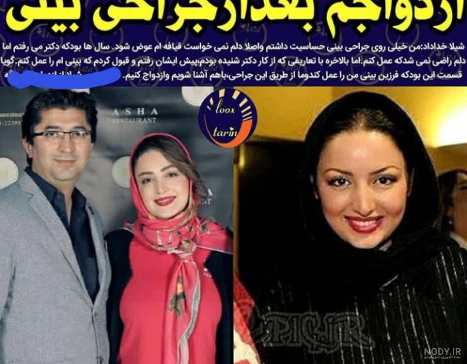 عمل زیبایی صورت بهاره رهنما عمل زیبایی صورت بهاره رهنما