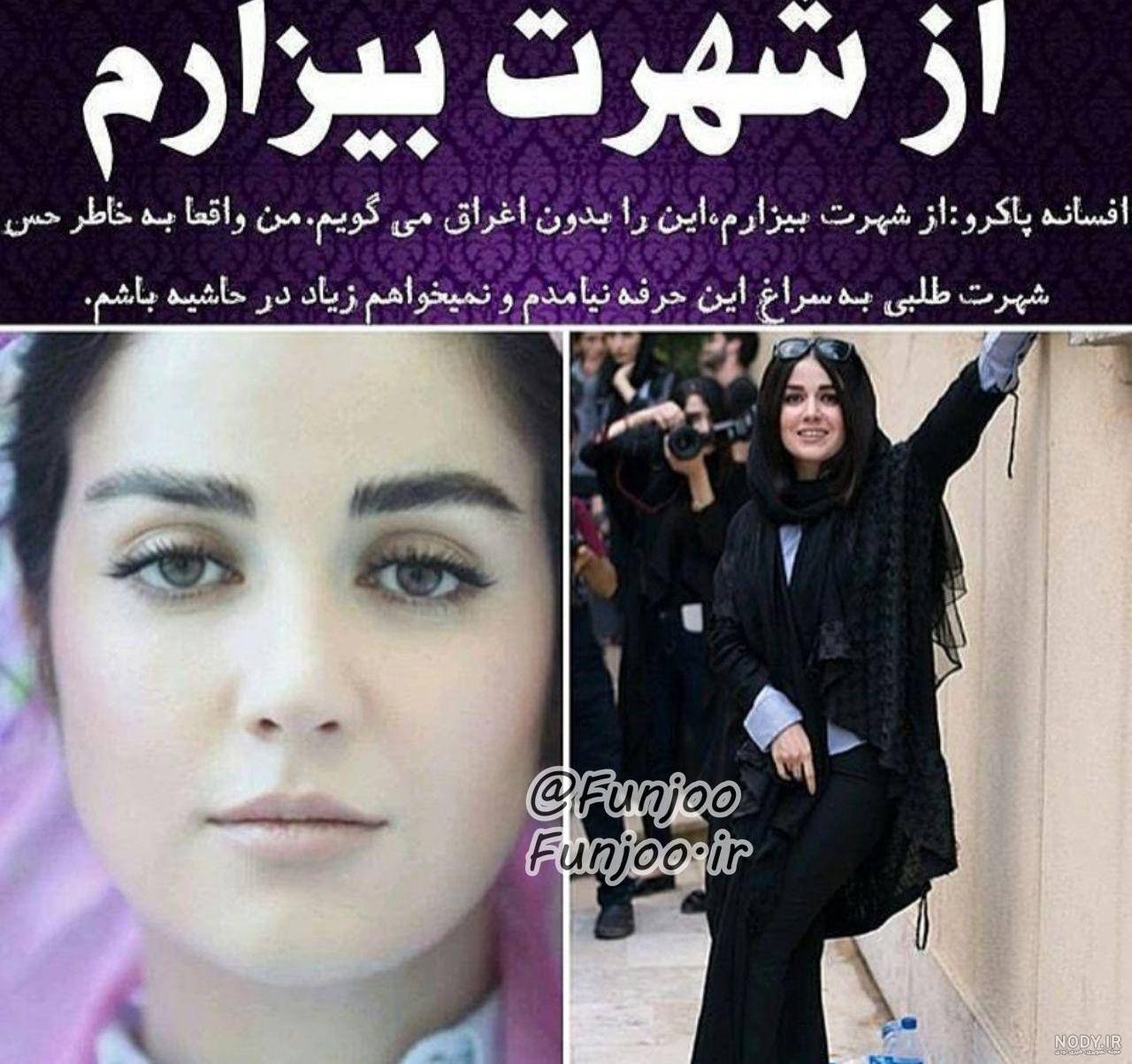 عمل زیبایی ناموفق بازیگران ایرانی عمل زیبایی ناموفق بازیگران ایرانی