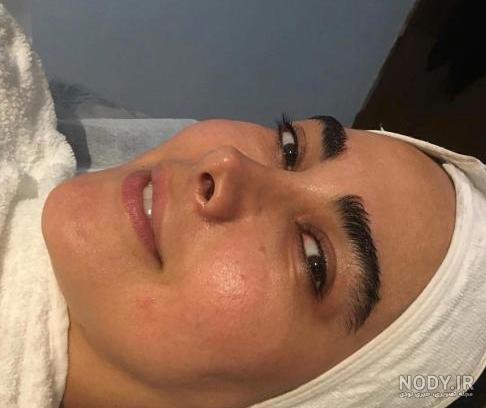عکس انا نعمتی قبل عمل عکس انا نعمتی قبل عمل