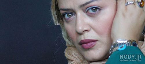 عکس بهاره رهنما قبل از عمل بینی عکس بهاره رهنما قبل از عمل بینی