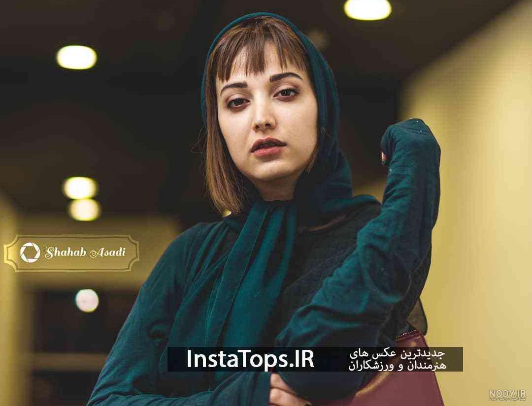 عکس روشنک گرامی قبل از عمل عکس روشنک گرامی قبل از عمل