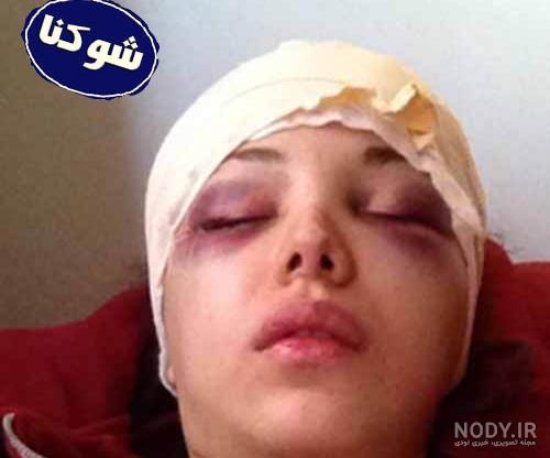 عکس روشنک گرامی قبل از عمل