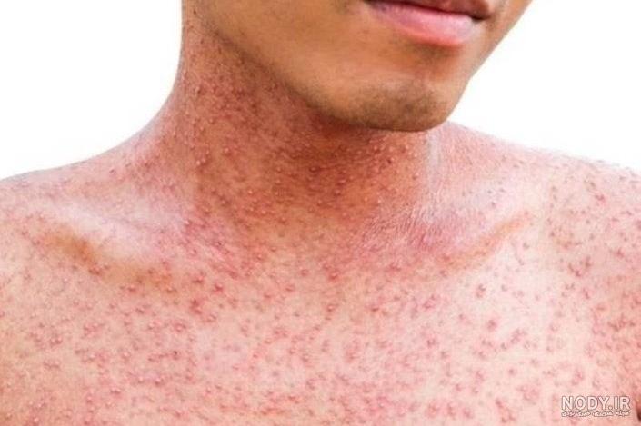 غذای مناسب دل درد کودکان