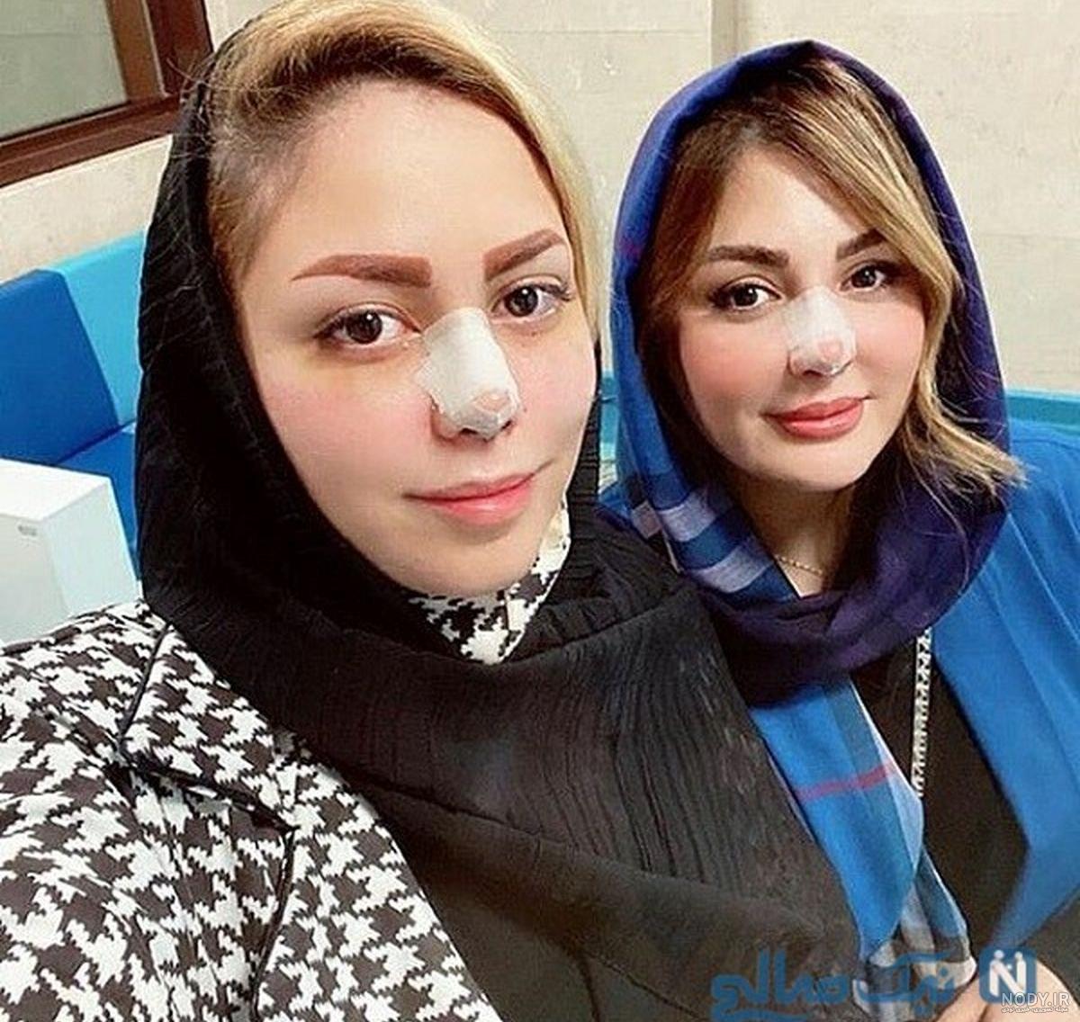 فرناز رهنما قبل از عمل بینی فرناز رهنما قبل از عمل بینی