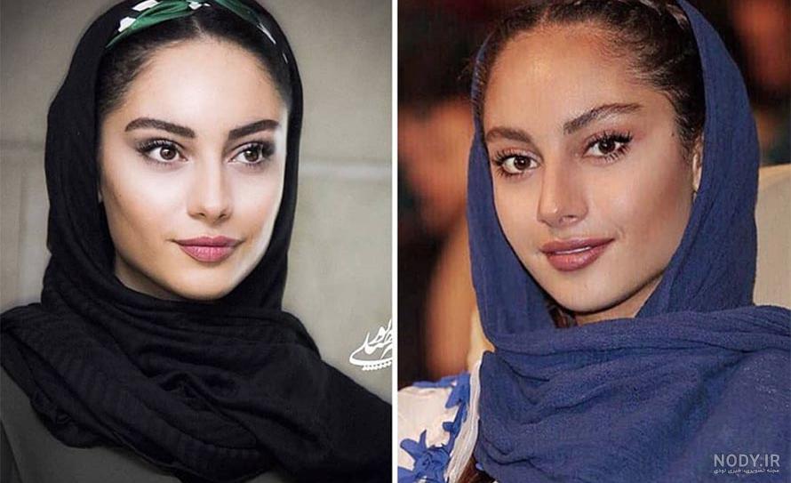 لب دادن ترلان پروانه و ارسلان قاسمی