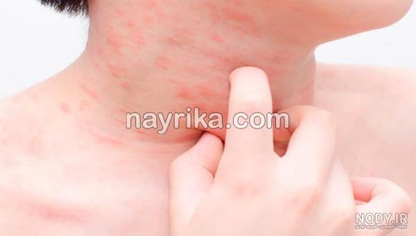 یک غذای مقوی برای مریض