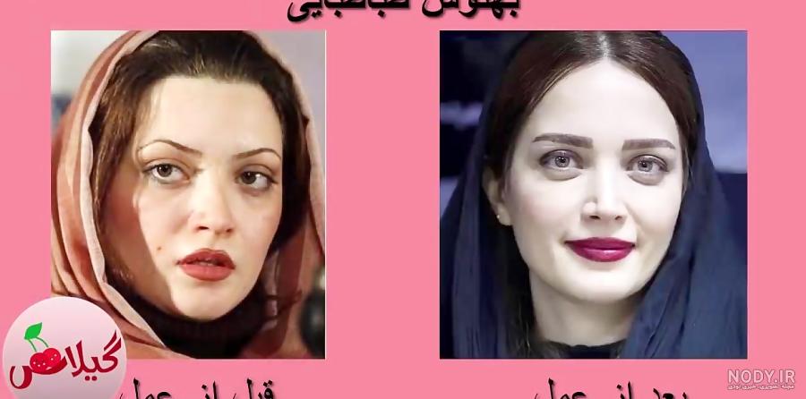 آیا افسانه پاکرو بینی اش را عمل کرده آیا افسانه پاکرو بینی اش را عمل کرده