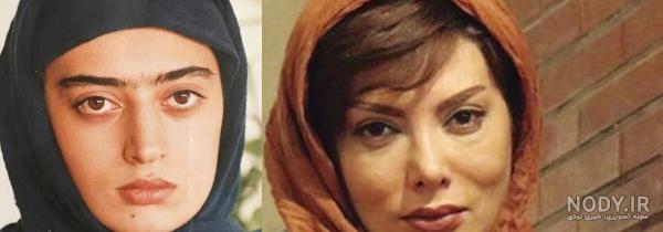 افسانه پاکرو قبل از عمل بینی افسانه پاکرو قبل از عمل بینی