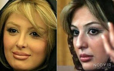 افسانه پاکرو قبل و بعد عمل بینی افسانه پاکرو قبل و بعد عمل بینی