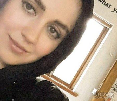 افسانه پاکرو قبل و بعد عمل بینی افسانه پاکرو قبل و بعد عمل بینی