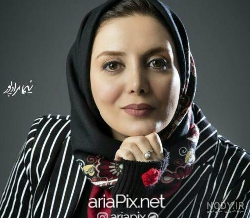 رویا میرعلمی قبل از عمل زیبایی رویا میرعلمی قبل از عمل زیبایی