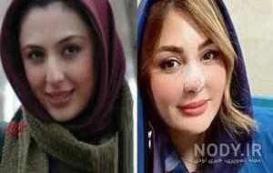 عکس افسانه پاکرو قبل از عمل عکس افسانه پاکرو قبل از عمل