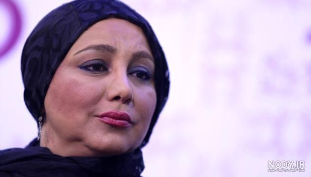 عکس بهنوش بختیاری قبل از عمل زیبایی بینی