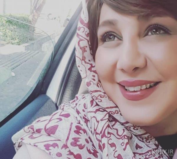 عکس بهنوش طباطبایی قبل از عمل بینی
