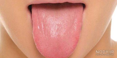 عکس دهن خونی برای پروفایل