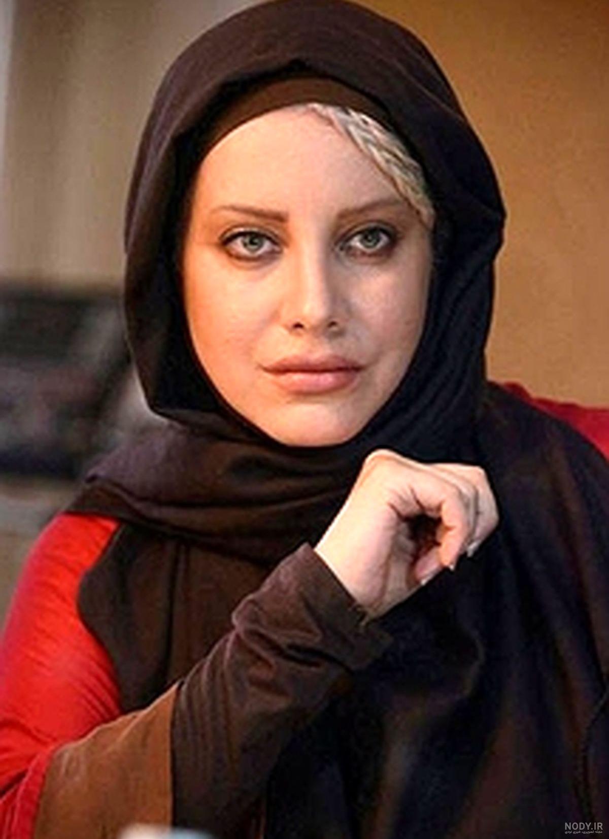 عکس شراره رخام بعد از تخلیه ژل لب عکس شراره رخام بعد از تخلیه ژل لب
