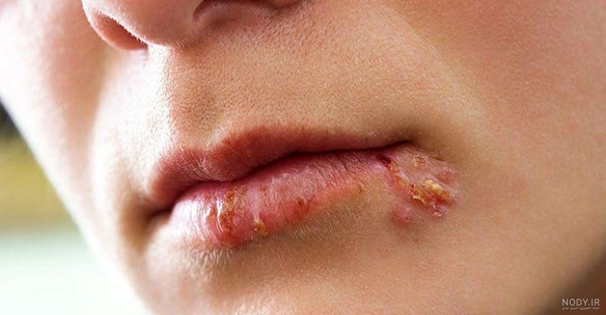 عکس لب برای پروفایل اینستا