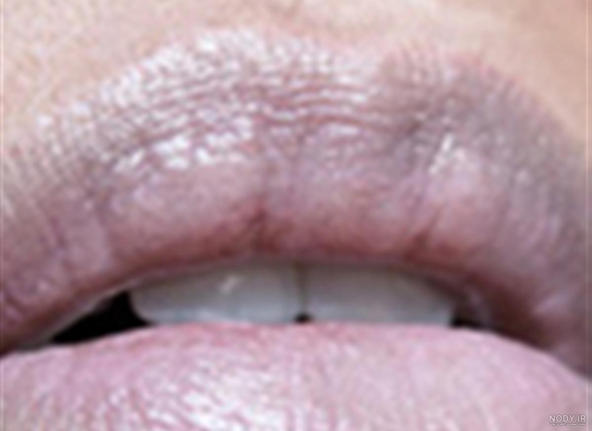 عکس پروفایل لب دختر و پسر