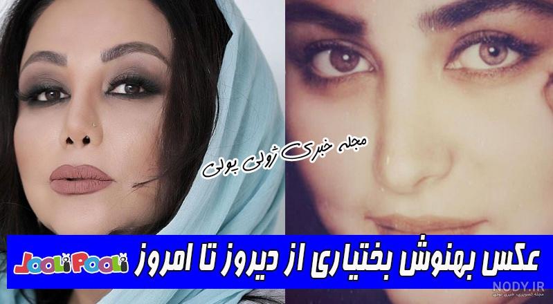 عکسهای بهنوش طباطبایی قبل از عمل بینی