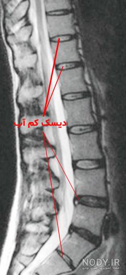 اصطلاحات ام ار ای اصطلاحات ام ار ای