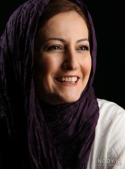 شقایق دهقان بعد از کاشت ابرو