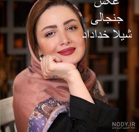 شیلا خداداد قبل از عمل شیلا خداداد قبل از عمل