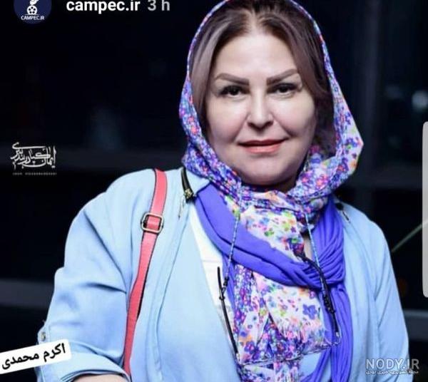 عکس اکرم محمدی بعد از عمل زیبایی عکس اکرم محمدی بعد از عمل زیبایی