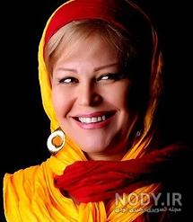 عکس اکرم محمدی بعد از عمل زیبایی عکس اکرم محمدی بعد از عمل زیبایی