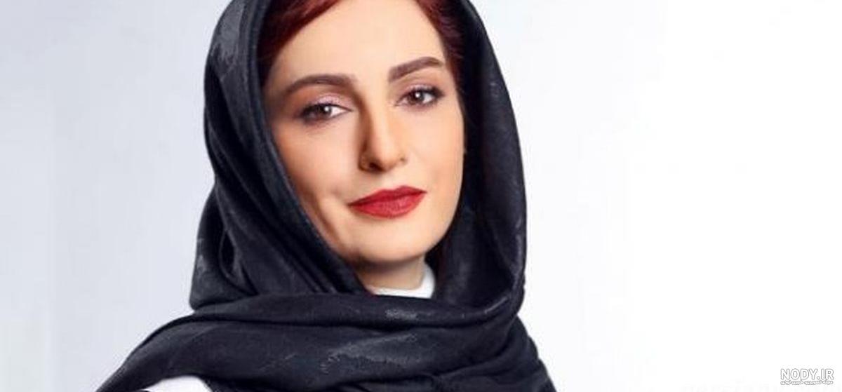 عکس شقایق دهقان قبل و بعد