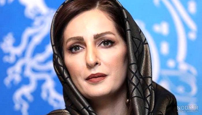 عکس شقایق دهقان قبل و بعد از عمل
