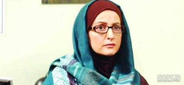 عکس شقایق دهقان قبل و بعد از عمل زیبایی