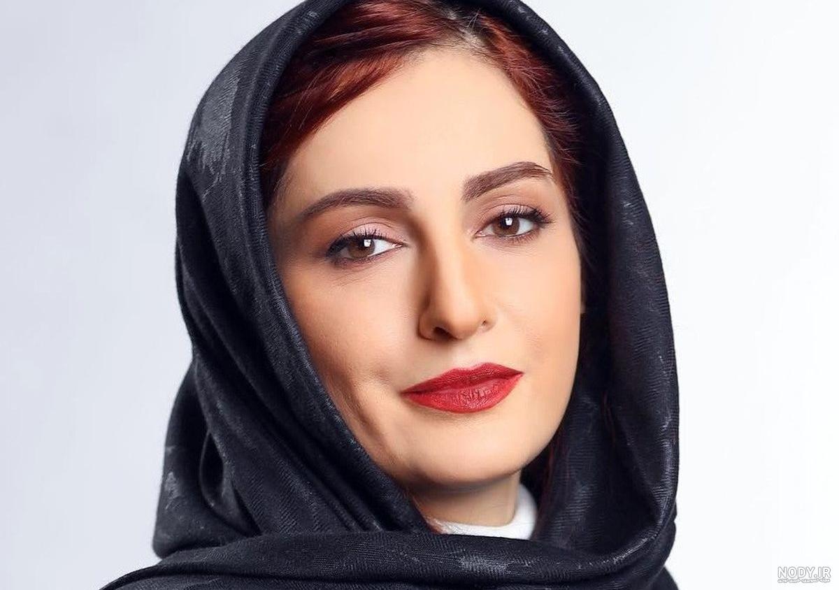 عکس شقایق دهقان قبل و بعد عمل