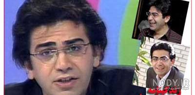 عکس قبل عمل فرزاد حسنی