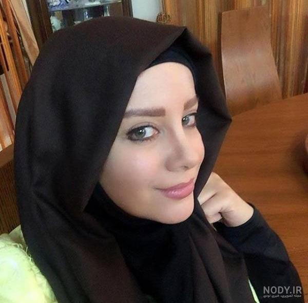 فاطمه گودرزی قبل و بعد از عمل زیبایی فاطمه گودرزی قبل و بعد از عمل زیبایی