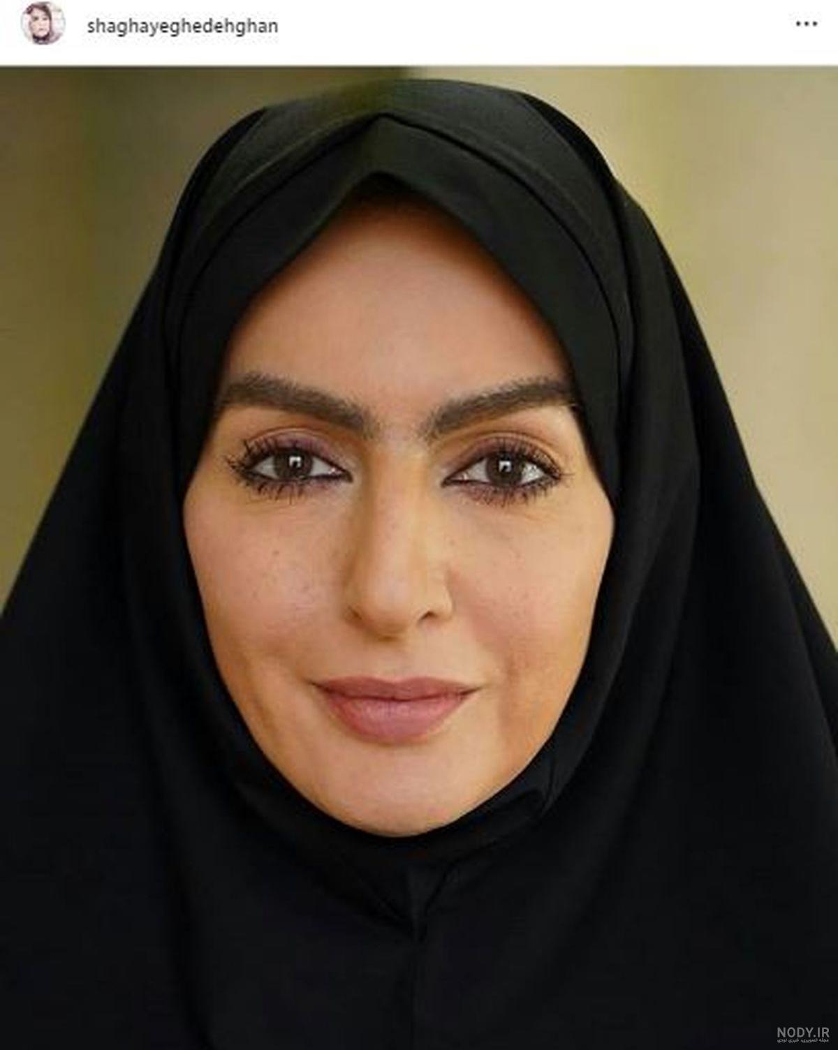 مراقبت بعد از کاشت ابرو