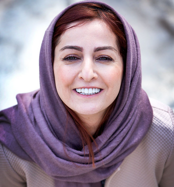 کاشت ابرو بعد از یکسال