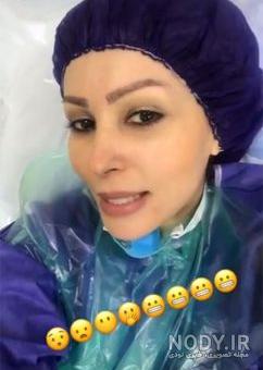 آشا محرابی قبل از عمل بینی آشا محرابی قبل از عمل بینی