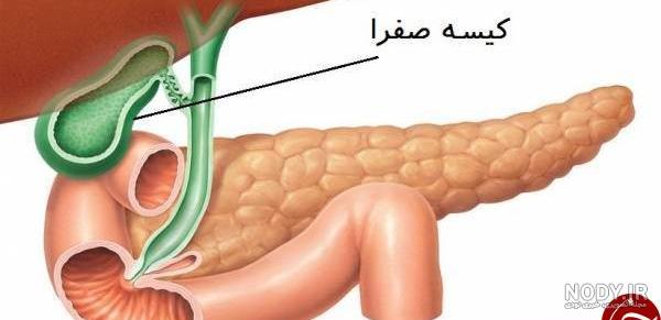 التهاب کیسه صفرا خطرناک است التهاب کیسه صفرا خطرناک است