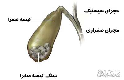 تفسیر سونوگرافی کیسه صفرا نی نی سایت تفسیر سونوگرافی کیسه صفرا نی نی سایت