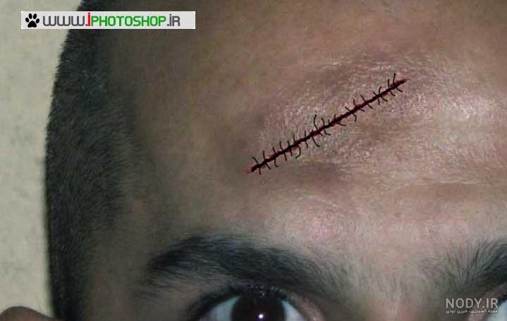 دانلود برنامه زخم فیک ساز دانلود برنامه زخم فیک ساز
