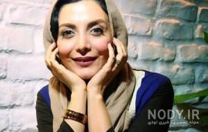رویا میرعلمی قبل از عمل زیبایی رویا میرعلمی قبل از عمل زیبایی