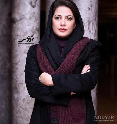 طناز طباطبایی قبل از عمل
