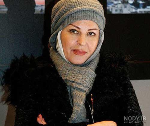 عمل زیبایی اکرم محمدی