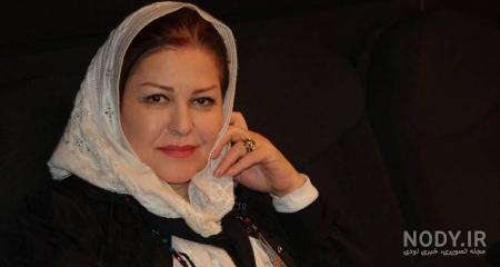 عمل زیبایی اکرم محمدی