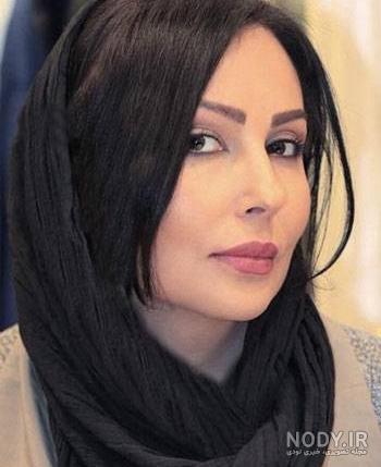 عمل زیبایی ناموفق بازیگران ایرانی عمل زیبایی ناموفق بازیگران ایرانی