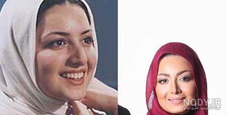 عکس بازیگران مرد ایرانی قبل از عمل زیبایی عکس بازیگران مرد ایرانی قبل از عمل زیبایی