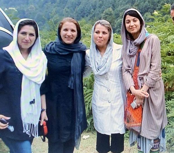 عکس روشنک گرامی قبل از عمل عکس روشنک گرامی قبل از عمل