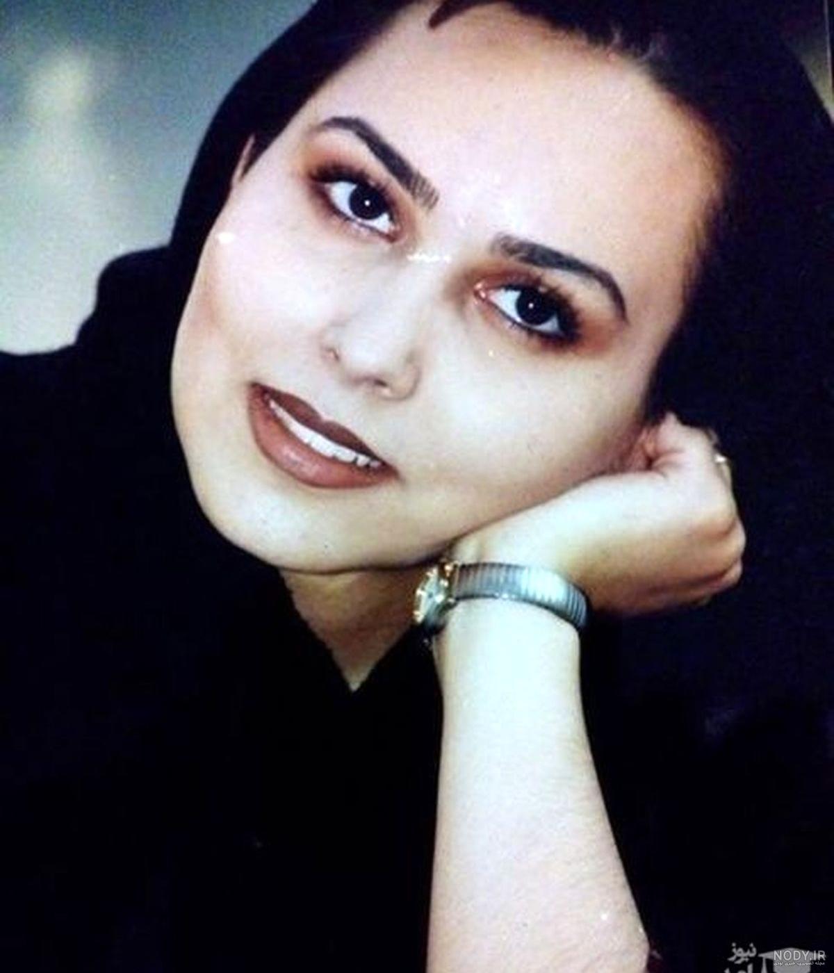 عکس زلیخا قبل از عمل زیبایی در فیلم چوکوروا عکس زلیخا قبل از عمل زیبایی در فیلم چوکوروا